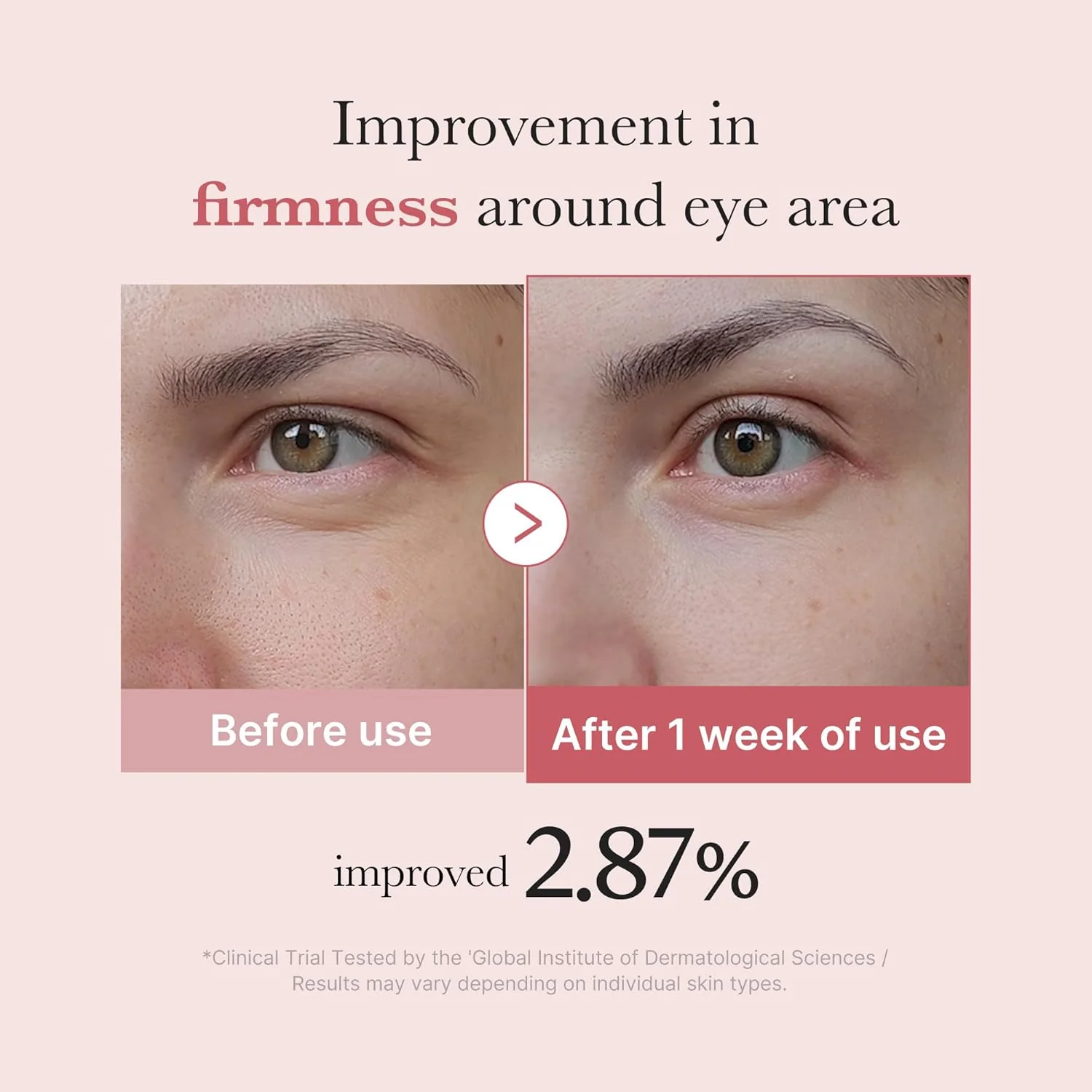 Medicube - PDRN Pink Peptide Eye Cream 30ml - Image 5